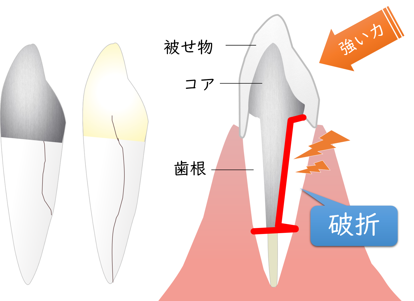 福岡市東区名島の歯医者で歯科用ＣＴ